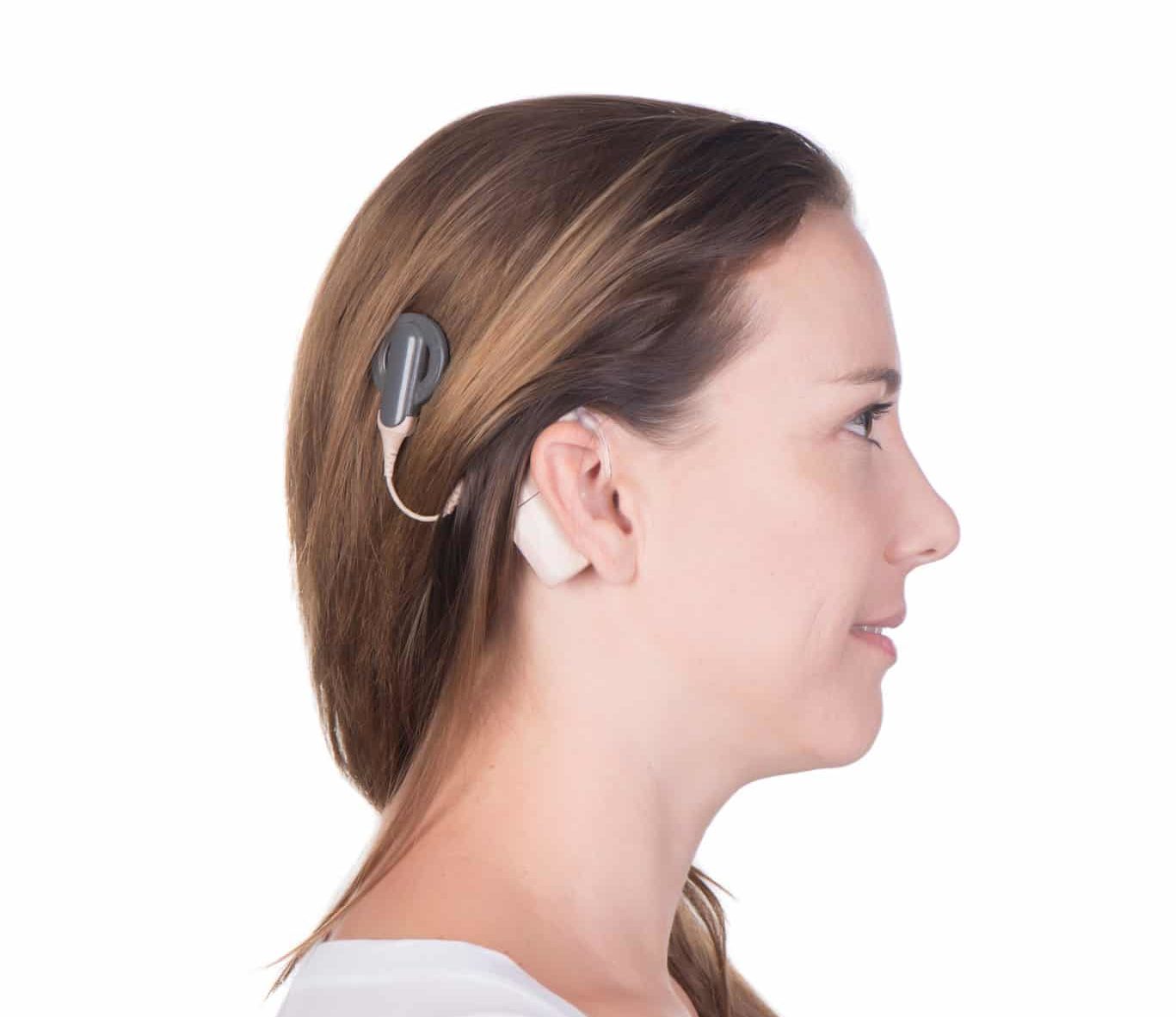 Cochlear Implants And Mapping Ear Nose And Throat Consultants